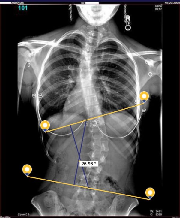 X-ray Review - Image 3