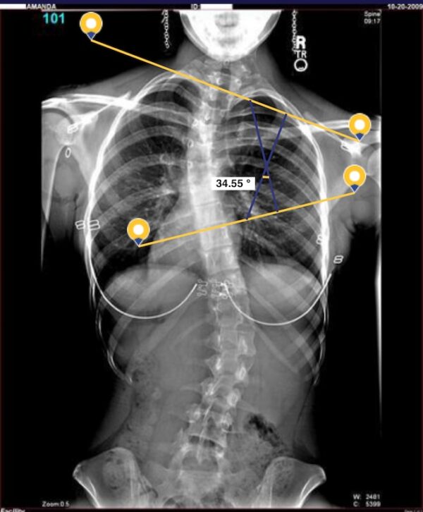 X-ray Review - Image 2