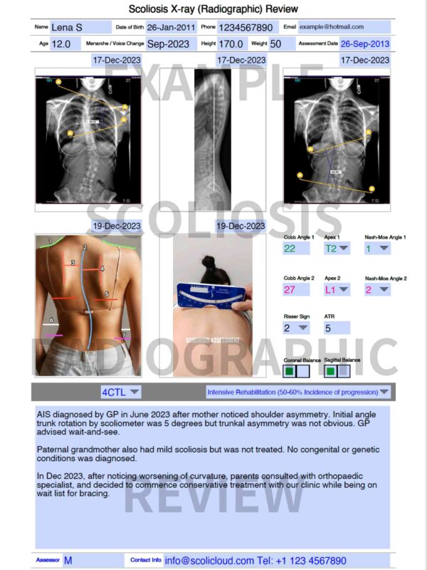 X-ray Review